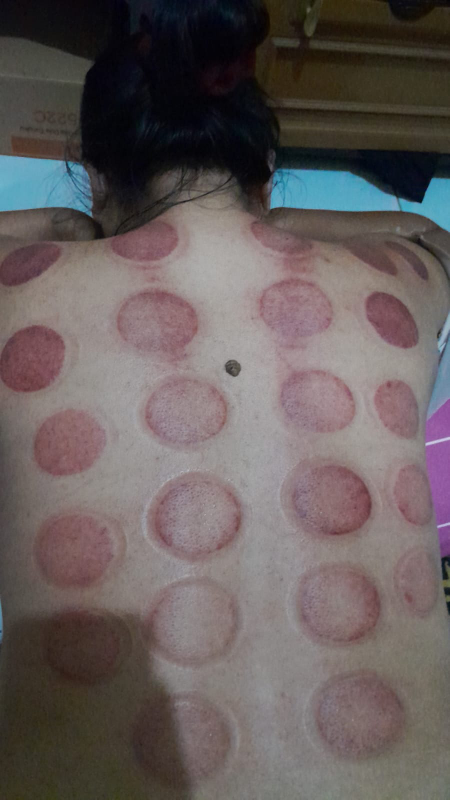 thes refleksi and masage